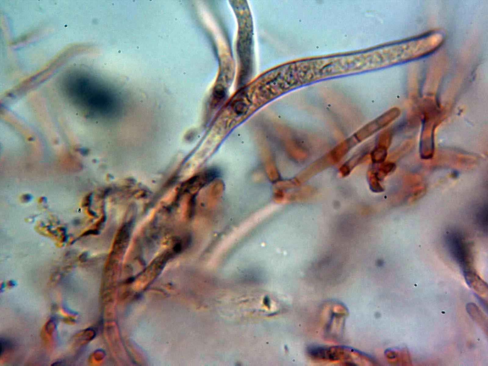 Microscopía de Russula decipiens - 10 - Pileocistidio 2